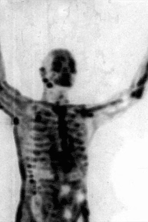 Kryengritësit Nuk Marrin Varre poster