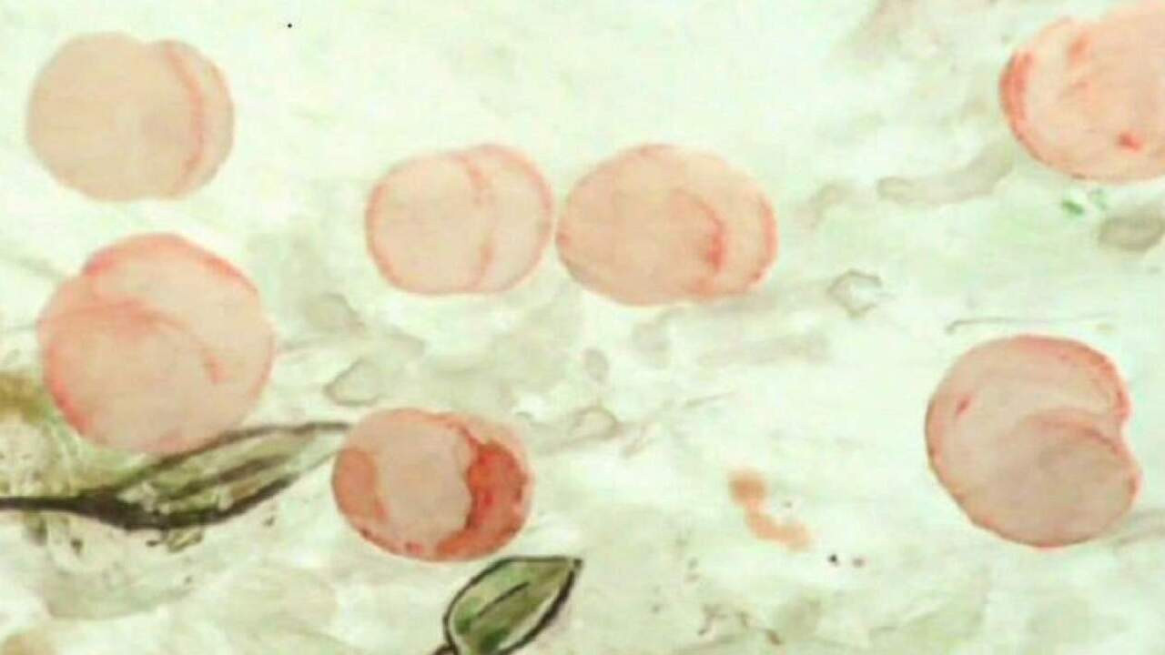 Derisa Të Bëhet Pluhur backdrop