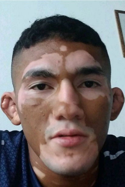 Melquizael Costa backdrop