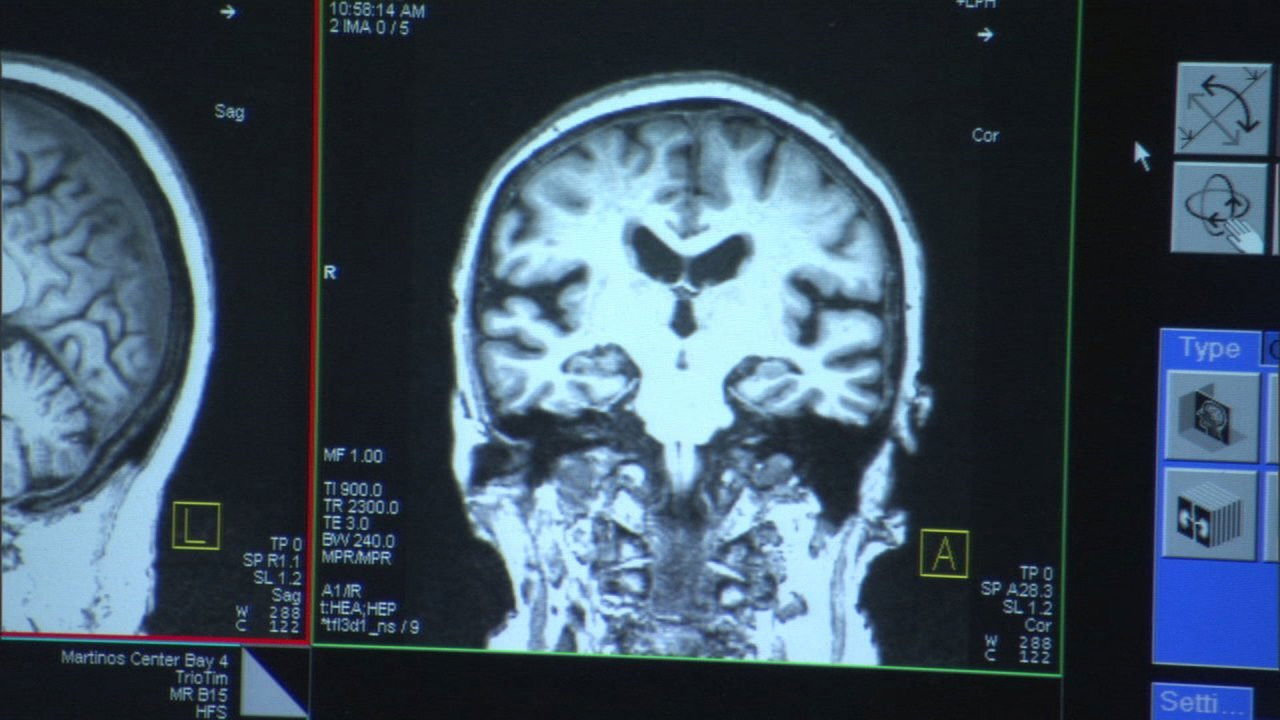 Projekti Alzheimerit backdrop